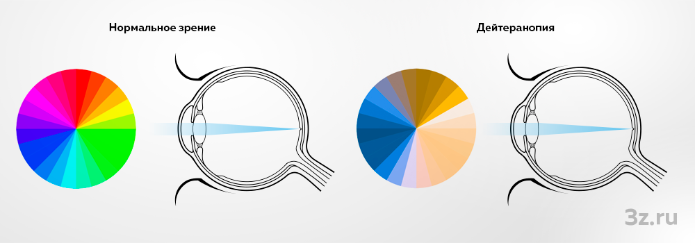 Нормальное зрение и дальтонизм (дейтеранопия) — 3Z